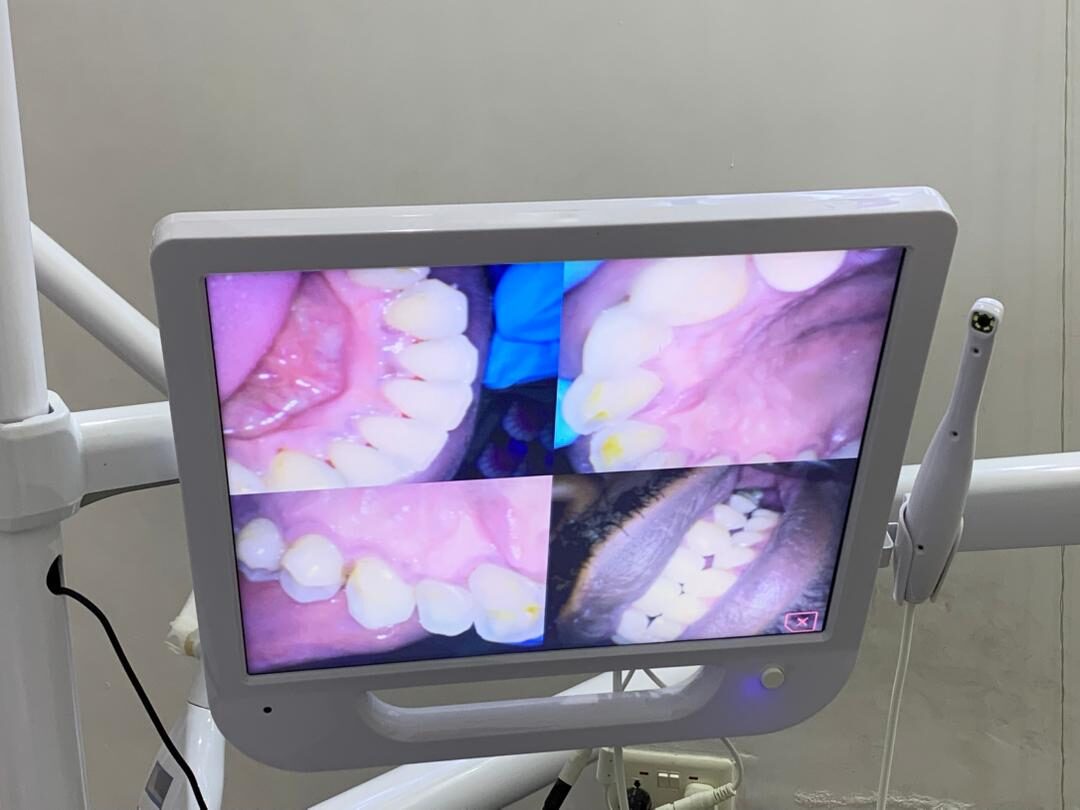 Every side of the mouth, cleaned — after treatment