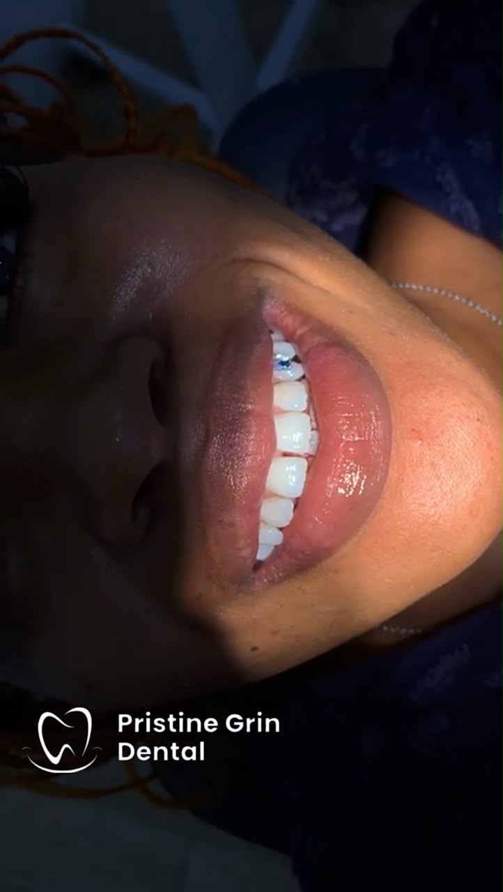 Patient smiling with a brighter smile after whitening treatment